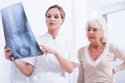 Рентгеновото изследване е информативен начин за диагностициране на остеохондроза на гръбначния стълб