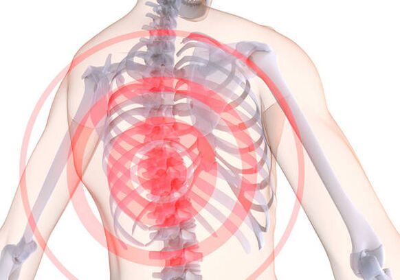Гръдната остеохондроза е придружена от дорсаго - остра болка, която ограничава мускулите