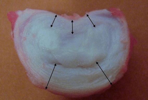 как изглежда междупрешленният диск